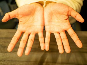 手相のしわが多い人は神経質・せっかちなタイプ?